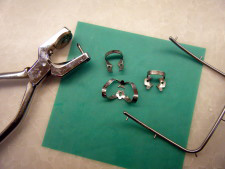 藤沢の歯医者で根管治療