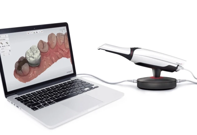 藤沢駅の歯医者、神谷デンタルオフィスの口空内スキャナー