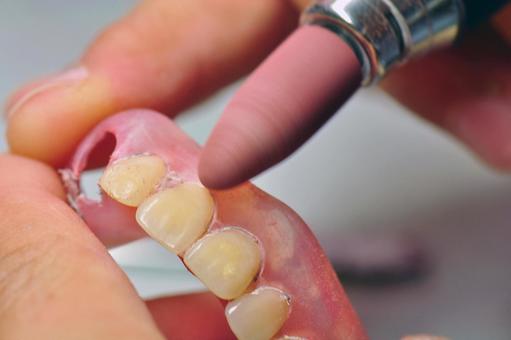 藤沢市の歯医者で入れ歯治療